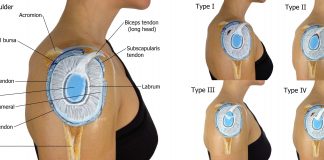 Slap Tear: el cuco de los lanzadores