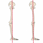 hyperextendedskeleton-451x450_1
