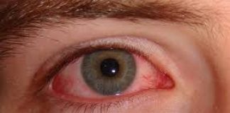 Si te gusta entrenar con sol, cuida tus ojos